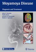 Moyamoya Disease