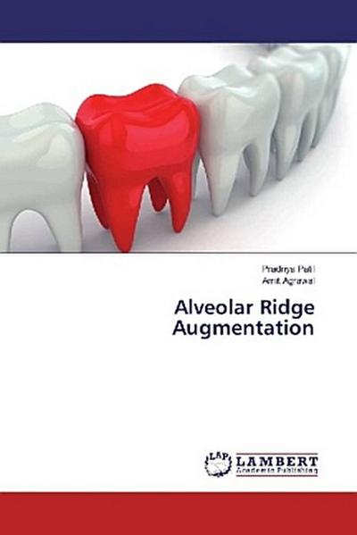 Alveolar Ridge Augmentation