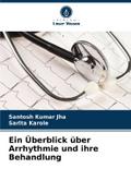 Ein Überblick über Arrhythmie und ihre Behandlung
