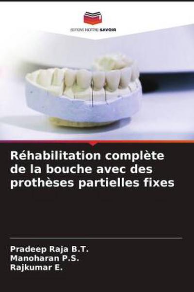Réhabilitation complète de la bouche avec des prothèses partielles fixes