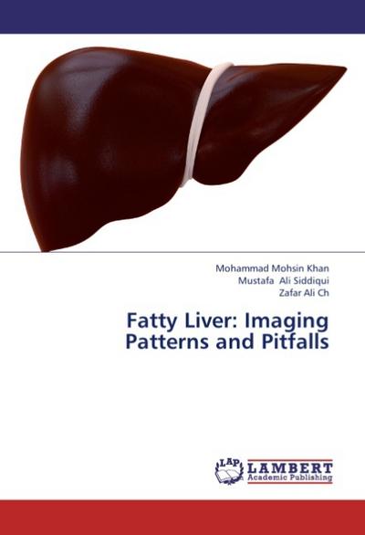 Fatty Liver: Imaging Patterns and Pitfalls