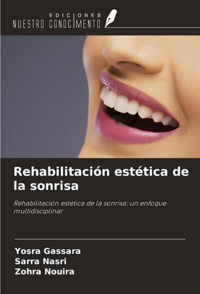 Rehabilitación estética de la sonrisa