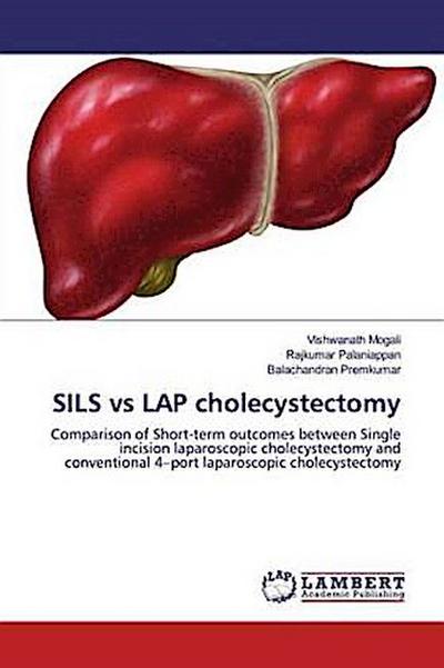 SILS vs LAP cholecystectomy