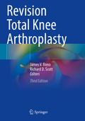 Revision Total Knee Arthroplasty