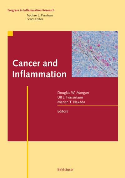 Cancer and Inflammation