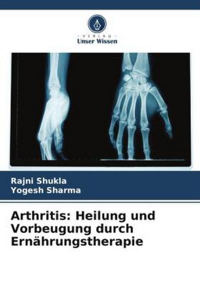 Arthritis: Heilung und Vorbeugung durch Ernährungstherapie