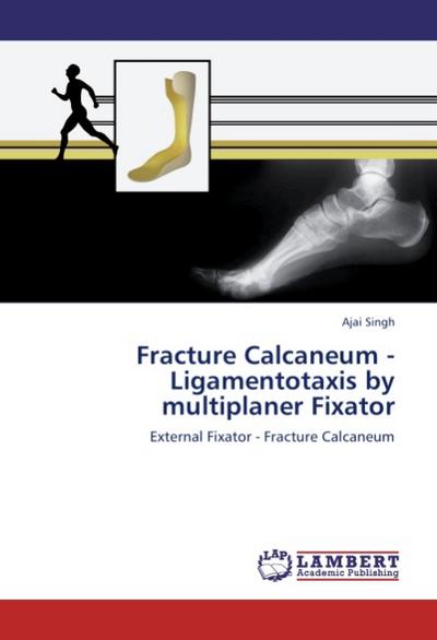 Fracture Calcaneum - Ligamentotaxis by multiplaner Fixator