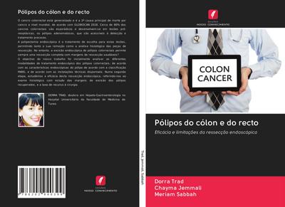 Pólipos do cólon e do recto