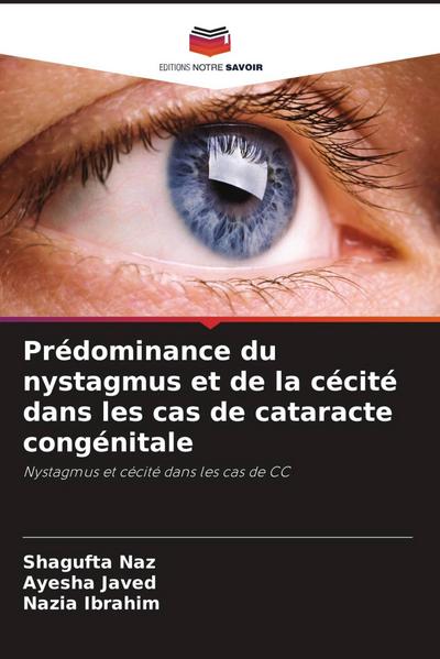 Prédominance du nystagmus et de la cécité dans les cas de cataracte congénitale
