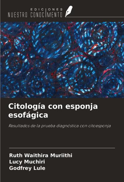 Citología con esponja esofágica
