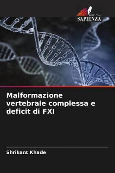 Malformazione vertebrale complessa e deficit di FXI