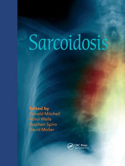 Sarcoidosis