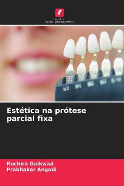Estética na prótese parcial fixa
