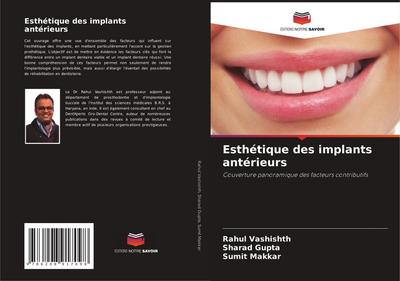 Esthétique des implants antérieurs