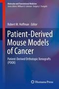 Patient-Derived Mouse Models of Cancer