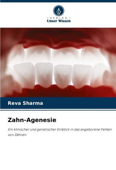 Zahn-Agenesie