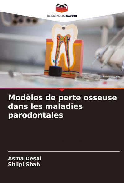 Modèles de perte osseuse dans les maladies parodontales