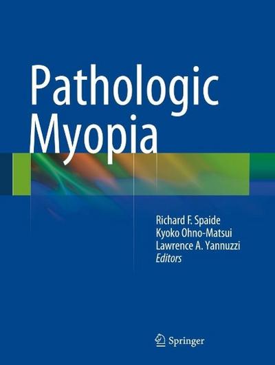 Pathologic Myopia