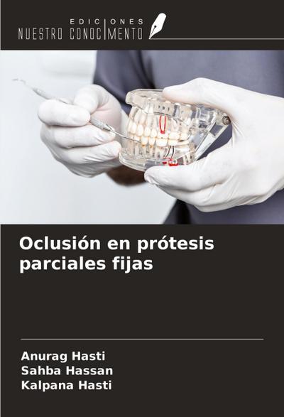Oclusión en prótesis parciales fijas
