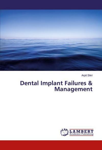 Dental Implant Failures & Management