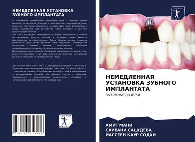 NEMEDLENNAYa USTANOVKA ZUBNOGO IMPLANTATA