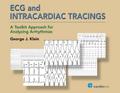 ECG and Intracardiac Tracings
