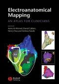 Electroanatomical Mapping