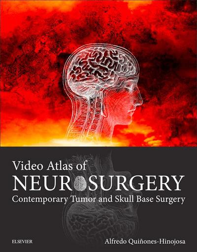 Video Atlas of Neurosurgery E-Book
