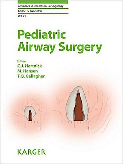 Pediatric Airway Surgery