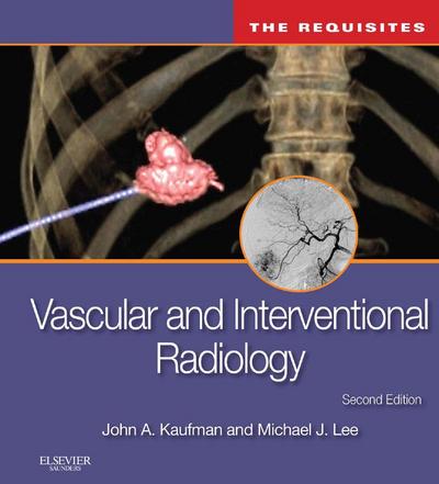 Vascular and Interventional Radiology: The Requisites E-Book