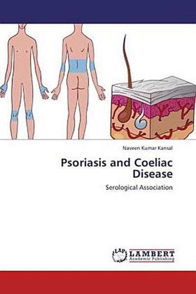 Psoriasis and Coeliac Disease