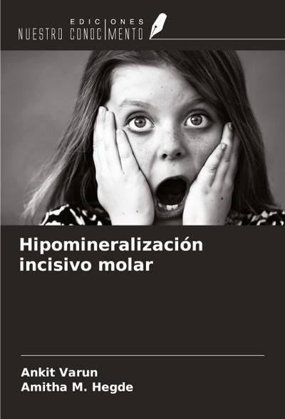 Hipomineralización incisivo molar