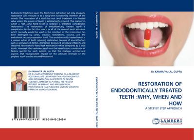 RESTORATION OF ENDODONTICALLY TREATED TEETH :WHY, WHEN AND HOW