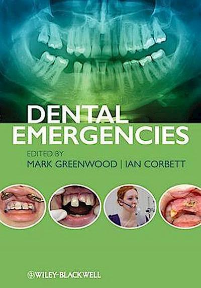 Dental Emergencies