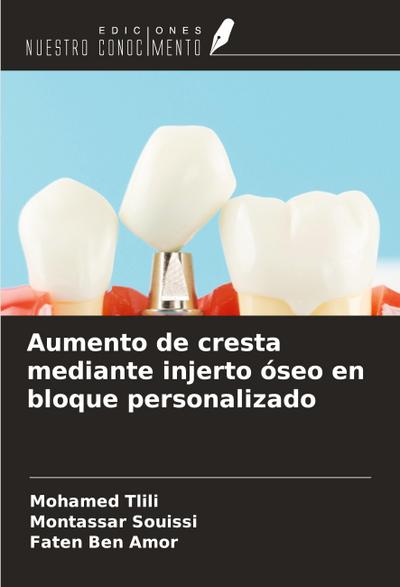 Aumento de cresta mediante injerto óseo en bloque personalizado