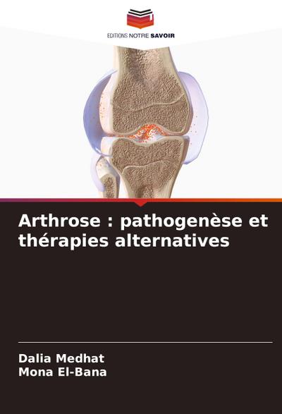 Arthrose : pathogenèse et thérapies alternatives