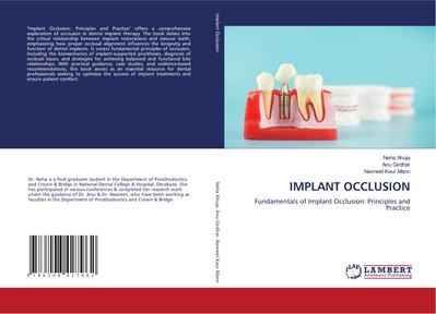 IMPLANT OCCLUSION