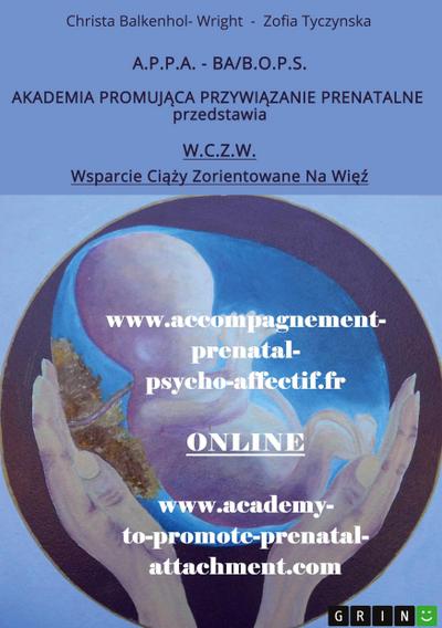 Wsparcie Ci¿¿y Zorientowane Na Wi¿¿ (W.C.Z.W.)