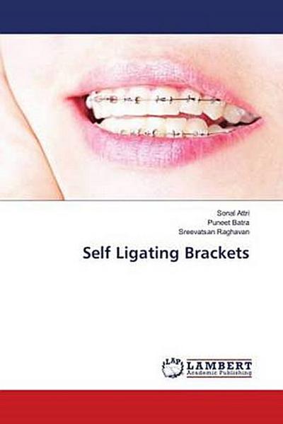 Self Ligating Brackets