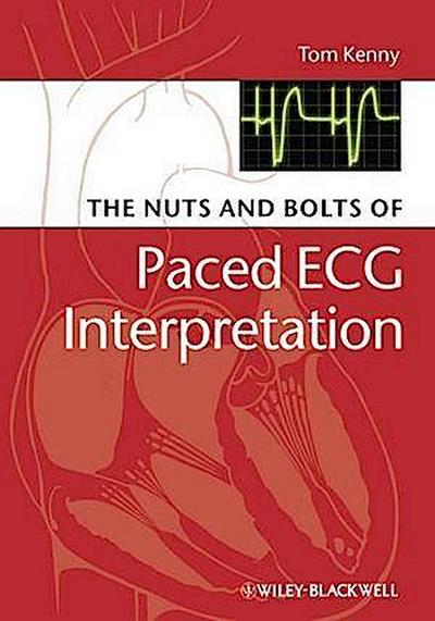 The Nuts and bolts of Paced ECG Interpretation
