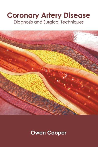 Coronary Artery Disease