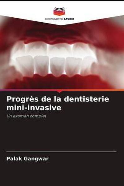 Progrès de la dentisterie mini-invasive