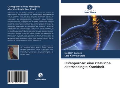Osteoporose: eine klassische altersbedingte Krankheit
