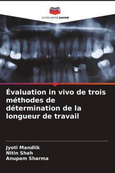 Évaluation in vivo de trois méthodes de détermination de la longueur de travail