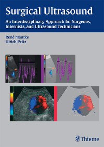 Surgical Ultrasound