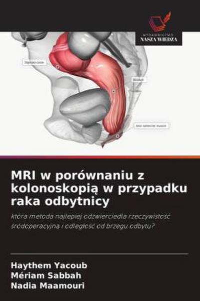 MRI w porównaniu z kolonoskopi¿ w przypadku raka odbytnicy