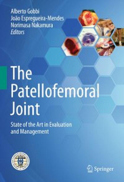 The Patellofemoral Joint