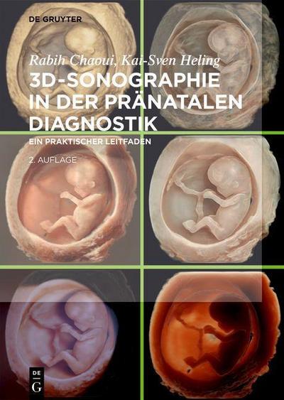 3D-Sonographie in der pränatalen Diagnostik