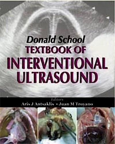 Antsaklis, A: Donald School Textbook of Interventional Ultra