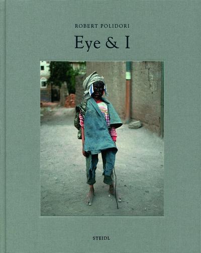 Eye and I